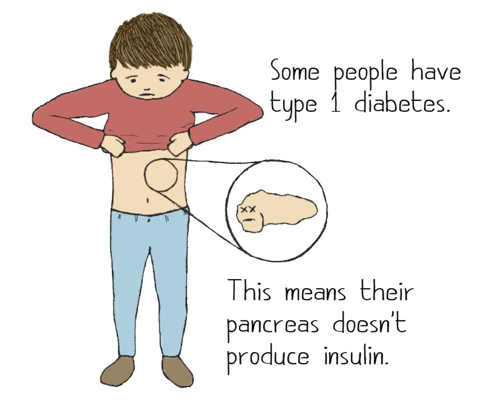type 1 diabetes insulin